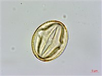 雙花金絲桃藏品圖，第3張