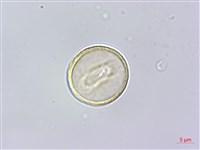 石月、橢圓葉石月藏品圖，第2張