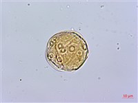 蘭嶼絡石藏品圖，第2張