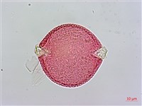 雞屎樹藏品圖，第1張