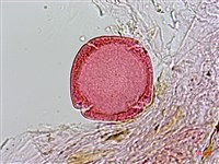 雞屎樹藏品圖，第3張