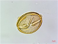 玉山金絲桃藏品圖，第3張