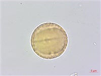 蘭嶼蘋婆藏品圖，第2張