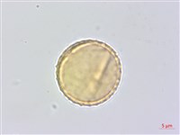 蘭嶼蘋婆藏品圖，第3張