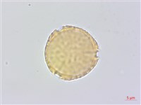 蘭嶼蘋婆藏品圖，第4張