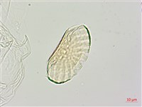 腎果小扁豆藏品圖，第1張