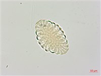 腎果小扁豆藏品圖，第2張