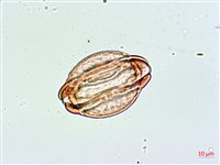 棋盤腳樹藏品圖，第2張