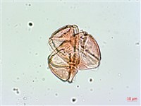 棋盤腳樹藏品圖，第3張