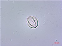 鵝掌藤藏品圖，第3張