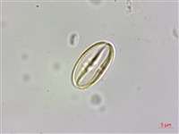 蘭嶼秋海棠藏品圖，第3張