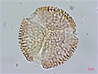 黃斑龍膽藏品圖，第1張