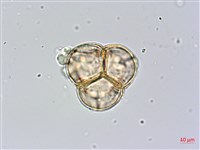 金毛杜鵑藏品圖，第2張