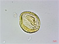 蘭嶼榿葉懸鉤子藏品圖，第2張