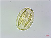 蘭嶼榿葉懸鉤子藏品圖，第3張