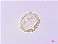 紫珠葉泡花藏品圖，第3張