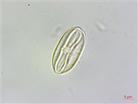 臺灣秋海棠藏品圖，第2張