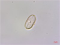 圓果秋海棠藏品圖，第2張