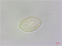 裂葉秋海棠藏品圖，第2張