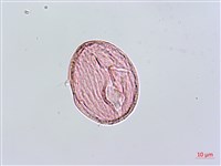 臺灣肺形草藏品圖，第2張