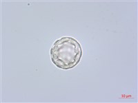 凹葉野莧菜藏品圖，第3張