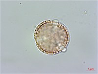 雞冠滇丁香藏品圖，第2張