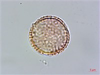 雞冠滇丁香藏品圖，第3張