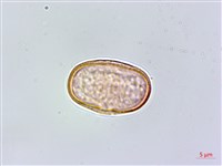 蘶山茴芹藏品圖，第1張