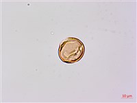 小槐花藏品圖，第2張