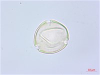 水晶蘭藏品圖，第1張