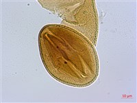 蘭嶼裸實藏品圖，第3張