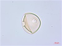 阿里山水晶蘭藏品圖，第1張