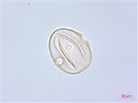 阿里山水晶蘭藏品圖，第2張