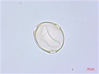 水晶蘭藏品圖，第3張