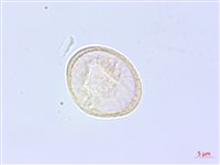 乞食碗藏品圖，第1張