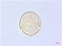 乞食碗藏品圖，第2張