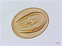 蘭嶼柿藏品圖，第3張