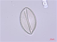 山寶鐸花藏品圖，第1張