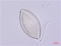 山寶鐸花藏品圖，第2張