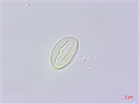 響鈴豆藏品圖，第2張