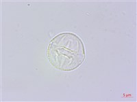 響鈴豆藏品圖，第3張