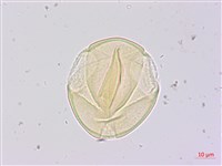 兔尾草藏品圖，第2張