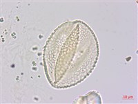 山珠豆藏品圖，第1張