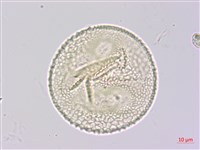 山珠豆藏品圖，第3張