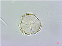 紅子莢迷藏品圖，第2張