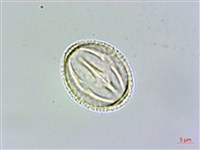 紅子莢迷藏品圖，第3張