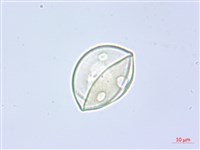 阿里山水晶蘭藏品圖，第3張