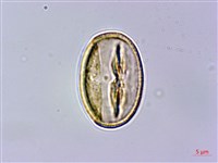 苦懸鉤子藏品圖，第2張