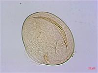 疣柄魔芋、雷公統、巨花蒟蒻、南天星藏品圖，第3張