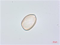 天門冬藏品圖，第2張